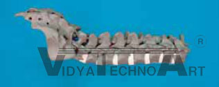 Spine lumbar, cancellous bone, T10- Sacrum, met. Coating